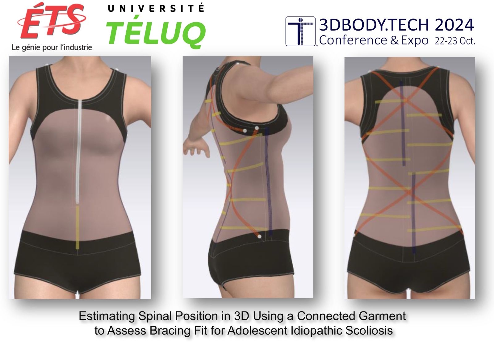 Visualisation 3D de la posture vertébrale grâce à un vêtement connecté pour la scoliose idiopathique adolescente